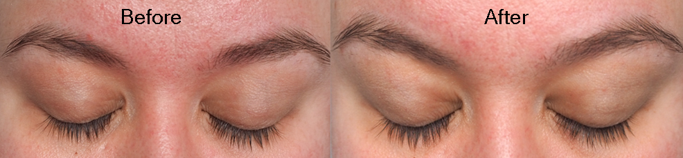 Lash growth serum before and after image