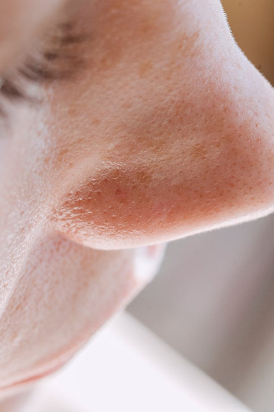 Nose and pores image