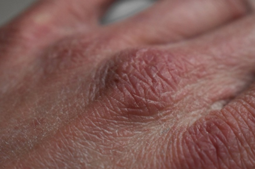 Dry hands image