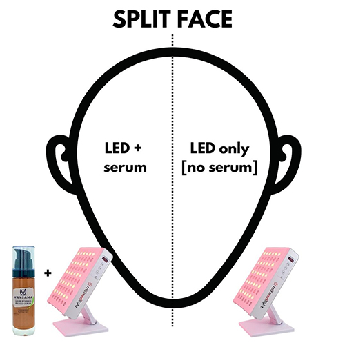 Split face diagram 