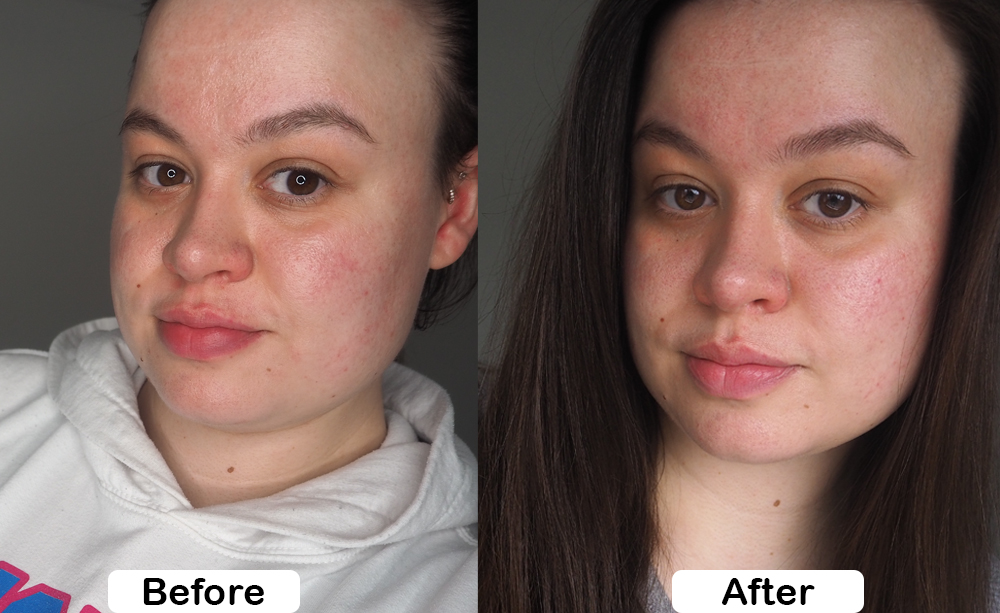 Revive Collagen Enhanced Plus before and after photo